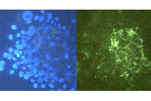 Immunocytochemistry staining of tenascin C in U-87 MG cells using purified mouse monoclonal antibody T2H7 (concentration in sample 12 μg/mL, GAM FITC, right picture) vs. (TNC 抗体)