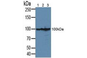 Western blot analysis of (1) Human 293T Cells, (2) Human PC-3 Cells and (3) Human MCF-7 Cells. (CD276 抗体  (AA 47-219))