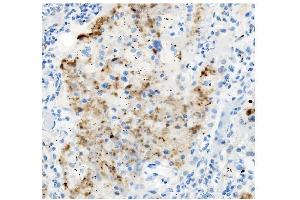 IHC analysis of ATG4A using anti-ATG4A antibody (ABIN7603108).