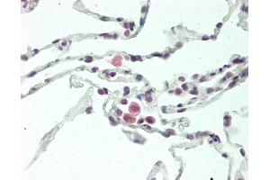 Immunohistochemistry (IHC) image for anti-Fc Fragment of IgA, Receptor For (FCAR) (AA 58-84) antibody (ABIN2601662)
