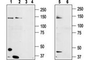 Western Blotting (WB) image for anti-Transient Receptor Potential Cation Channel, Subfamily M, Member 8 (TRPM8) (AA 917-929), (Extracellular) antibody (ABIN7043837)