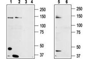 Western blot analysis of prostate carcinoma cell lines DU145 (lanes 1 and 3), Human LNCaP prostate carcinoma (lanes 2 and 4) and mouse-TRPM8 transfected HEK-293 (lanes 5 and 6) cell lysates: - 1,2,5. (TRPM8 抗体  (3rd Extracellular Loop))