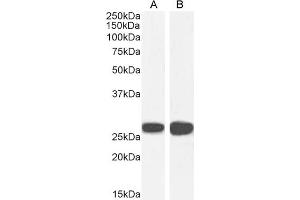 Western Blotting (WB) image for anti-Stratifin (SFN) (Internal Region) antibody (ABIN185539)
