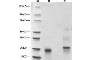 5 μg of IL-4, Mouse was resolved with SDS-PAGE under reducing (R) and non-reducing (N) conditions and visualized by Coomassie Blue staining. (IL-4 Protein (AA 23-140))