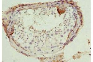 Immunohistochemistry of paraffin-embedded human testis tissue using ABIN7165308 at dilution of 1:100 (DR1 抗体  (AA 1-176))