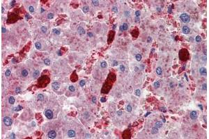 Human Liver: Formalin-Fixed, Paraffin-Embedded (FFPE) (Cell Adhesion Molecule 4 抗体  (AA 370-384))