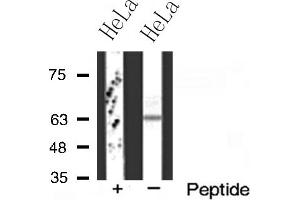 Western blot analysis of FZD2 expression in HeLa cells (FZD2 抗体  (Internal Region))