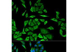 Immunofluorescence analysis of MCF-7 cells using DBI Polyclonal Antibody (Diazepam Binding Inhibitor 抗体)