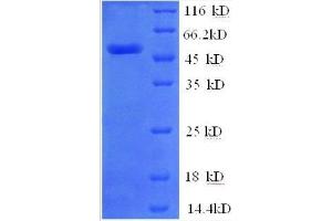 ZNF592 Protein (AA 1-242, partial) (GST tag)