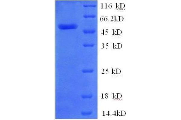ZNF592 Protein (AA 1-242, partial) (GST tag)