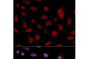 Immunofluorescence analysis of U2OS cells using TNNC1 Polyclonal Antibody (TNNC1 抗体)