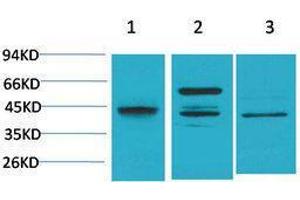 Western Blotting (WB) image for anti-Caspase 8 (CASP8) antibody (ABIN3188046) (Caspase 8 抗体)