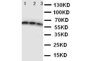 Anti-CD40 antibody,  Western blotting Lane 1: Recombinant Human CD40 Protein 10ng Lane 2: Recombinant Human CD40 Protein 5ng Lane 3: Recombinant Human CD40 Protein 2. (CD40 抗体  (N-Term))