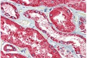 Kidney, Human: Formalin-Fixed, Paraffin-Embedded (FFPE) (HSPD1 抗体)