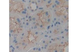 IHC-P analysis of Human Tissue, with DAB staining. (TMEM27 抗体  (AA 17-137))