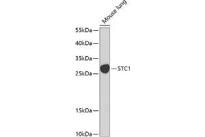 Western blot analysis of extracts of mouse lung, using STC1 Antibody (ABIN6128750, ABIN6148585, ABIN6148586 and ABIN6222488) at 1:1000 dilution.