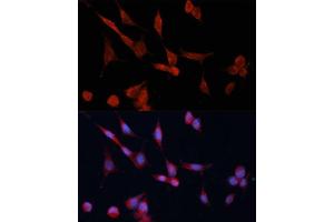 Immunofluorescence analysis of NIH-3T3 cells using DD Polyclonal Antibody (ABIN6127748, ABIN6139455, ABIN6139456 and ABIN6214493) at dilution of 1:100 (40x lens). (DDAH1 抗体  (AA 1-285))