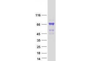 Western Blotting (WB) image for Zinc Finger Protein 306 (ZKSCAN3) protein (Myc-DYKDDDDK Tag) (ABIN2735992)