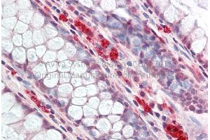 Rabbit Anti-SMARCE1 antibody  Formalin Fixed Paraffin Embedded Tissue: Human Adult Colon  Observed Staining: Cytoplasm in hepatocytes Primary Antibody Concentration: 1:600 Secondary Antibody: Donkey anti-Rabbit-Cy3 Secondary Antibody Concentration: 1:200 Magnification: 20X Exposure Time: 0.