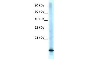WB Suggested Anti-CDKN2B Antibody Titration:  0. (CDKN2B 抗体  (Middle Region))