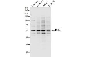 WB Image ZNF24 antibody detects ZNF24 protein by western blot analysis. (ZNF24 抗体)