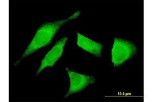 Immunofluorescence of monoclonal antibody to UTRN on HeLa cell. (Utrophin 抗体  (AA 3328-3433))