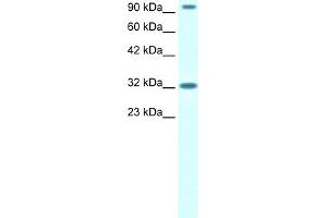 WB Suggested Anti-CIC Antibody Titration:  1. (CIC 抗体  (N-Term))