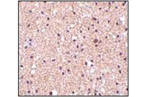 Immunohistochemistry of op18 in human brain tissue with this product at 2. (Stathmin 1 抗体  (C-Term))