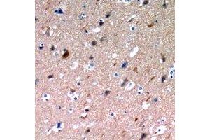 Immunohistochemical analysis of NLRX1 staining in human brain formalin fixed paraffin embedded tissue section. (NLRX1 抗体)