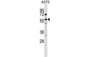 Western Blotting (WB) image for anti-Sorting Nexin 2 (SNX2) antibody (ABIN2998549) (Sorting Nexin 2 抗体)