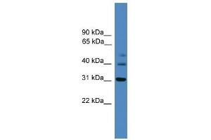 TRIB1 antibody used at 0. (TRIB1 抗体  (C-Term))