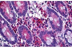 Anti-LIMK1 antibody IHC staining of human small intestine. (LIM Domain Kinase 1 抗体  (AA 548-648))