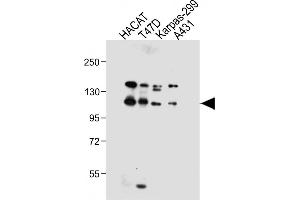 All lanes : Anti-RN2 Antibody (C-term) at 1:1000 dilution Lane 1: HACAT whole cell lysate Lane 2: T47D whole cell lysate Lane 3: Karpas-299 whole cell lysate Lane 4: A431 whole cell lysate Lysates/proteins at 20 μg per lane. (MMRN2 抗体  (C-Term))