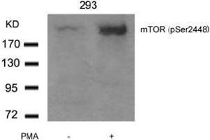 Image no. 3 for anti-Mechanistic Target of Rapamycin (serine/threonine Kinase) (mTOR) (pSer2448) antibody (ABIN196963) (MTOR 抗体  (pSer2448))