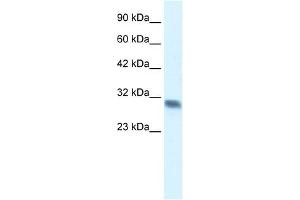 Western Blot showing FHL2 antibody used at a concentration of 1-2 ug/ml to detect its target protein. (FHL2 抗体  (C-Term))