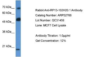 Western Blotting (WB) image for anti-rho GTPase Activating Protein 36 (ARHGAP36) (N-Term) antibody (ABIN406257) (ARHGAP36 抗体  (N-Term))