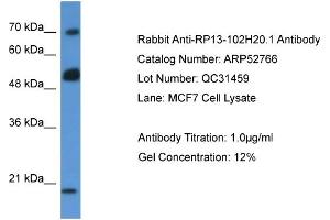 Western Blotting (WB) image for anti-rho GTPase Activating Protein 36 (ARHGAP36) (N-Term) antibody (ABIN2785083) (ARHGAP36 抗体  (N-Term))