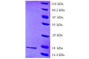 Protein expressed in Baculovirus.