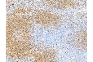 Immunohistochemistry (IHC) image for anti-CD79b Molecule, Immunoglobulin-Associated beta (CD79B) (AA 200-250) antibody (ABIN7454006)