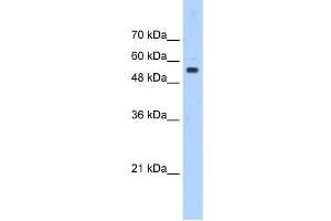 PODXL antibody used at 0. (PODXL 抗体  (Middle Region))