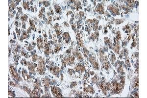Immunohistochemical staining of paraffin-embedded prostate tissue using anti-MTRF1L mouse monoclonal antibody. (MTRF1L 抗体)