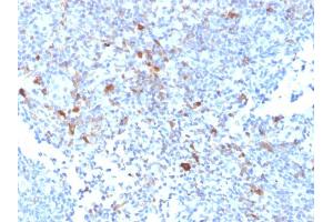 Formalin-fixed, paraffin-embedded human Lymph Node stained with TRAF1 Mouse Monoclonal Antibody (TRAF1/2770). (TRAF1 抗体  (AA 73-219))