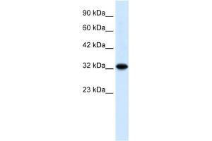 WB Suggested Anti-ZBTB32 Antibody Titration: 0. (ZBTB32 抗体  (N-Term))