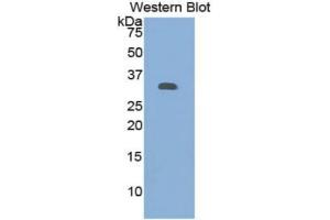 WB of Protein Standard: different control antibodies  against Highly purified E. (Granulin ELISA 试剂盒)
