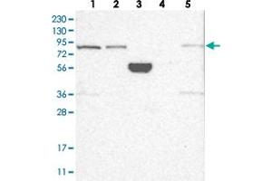 Western blot analysis of Lane 1: RT-4, Lane 2: U-251 MG, Lane 3: Human Plasma, Lane 4: Liver, Lane 5: Tonsil with SCLT1 polyclonal antibody . (Sclt1 抗体)