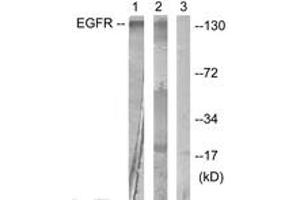 Western blot analysis of extracts from HuvEc cells, treated with Serum 20% 30', using EGFR (Ab-1016) Antibody. (EGFR 抗体  (AA 986-1035))