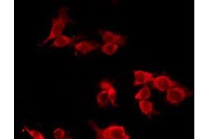 ABIN6277548 staining Hela by IF/ICC. (CHRM5 抗体  (C-Term))