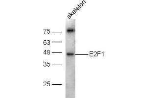 Mouse skeleton lysates probed with E2F1 Polyclonal Antibody, Unconjugated  at 1:300 dilution and 4˚C overnight incubation. (E2F1 抗体  (AA 101-180))