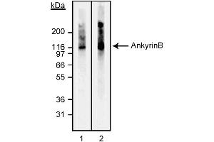 Western blot analysis of Ankyrin B. (ANK2 抗体)