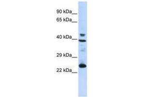 Image no. 1 for anti-Selenoprotein P (SEPP1) (AA 35-84) antibody (ABIN6743265) (Selenoprotein P 抗体  (AA 35-84))